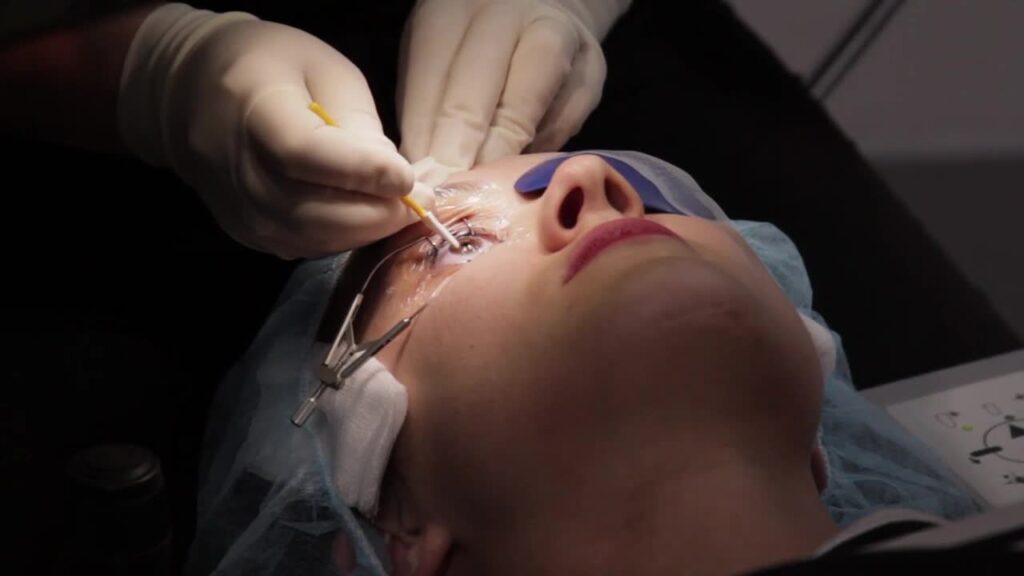 cataract surgery