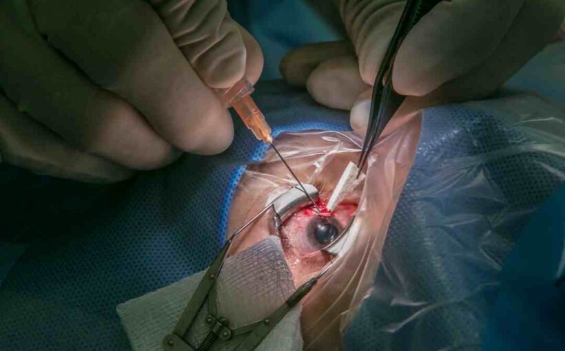 Cataract Surgery in Australia: Types, Risks, Recovery & Treatment Options